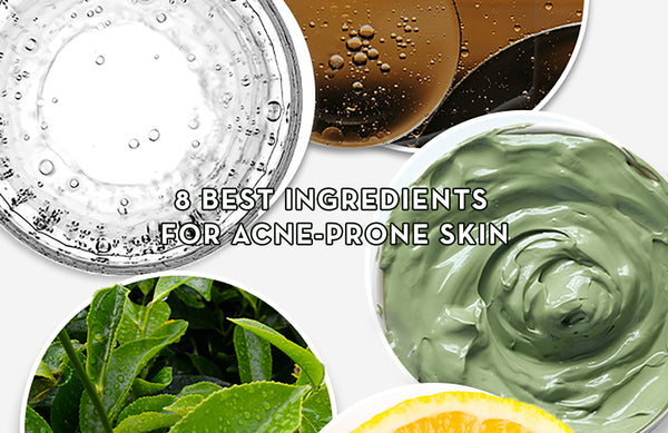 8 Best Ingredients for Acne-Prone Skin