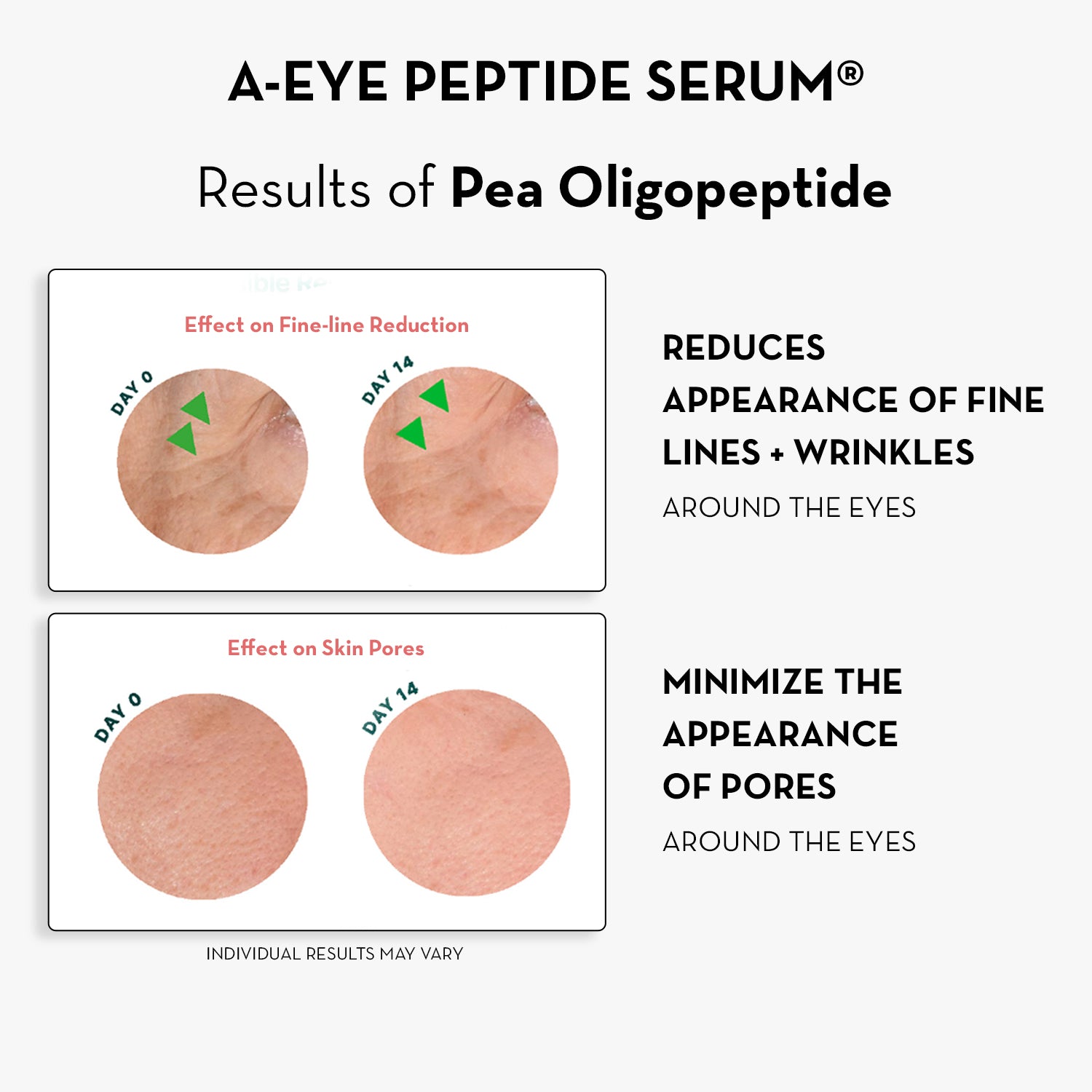 Advertisement for A-Eye Peptide Serum showing before and after effects on fine lines and skin pores.
