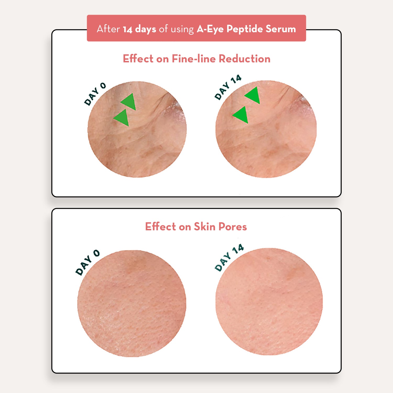 A-Eye Peptide Serum®