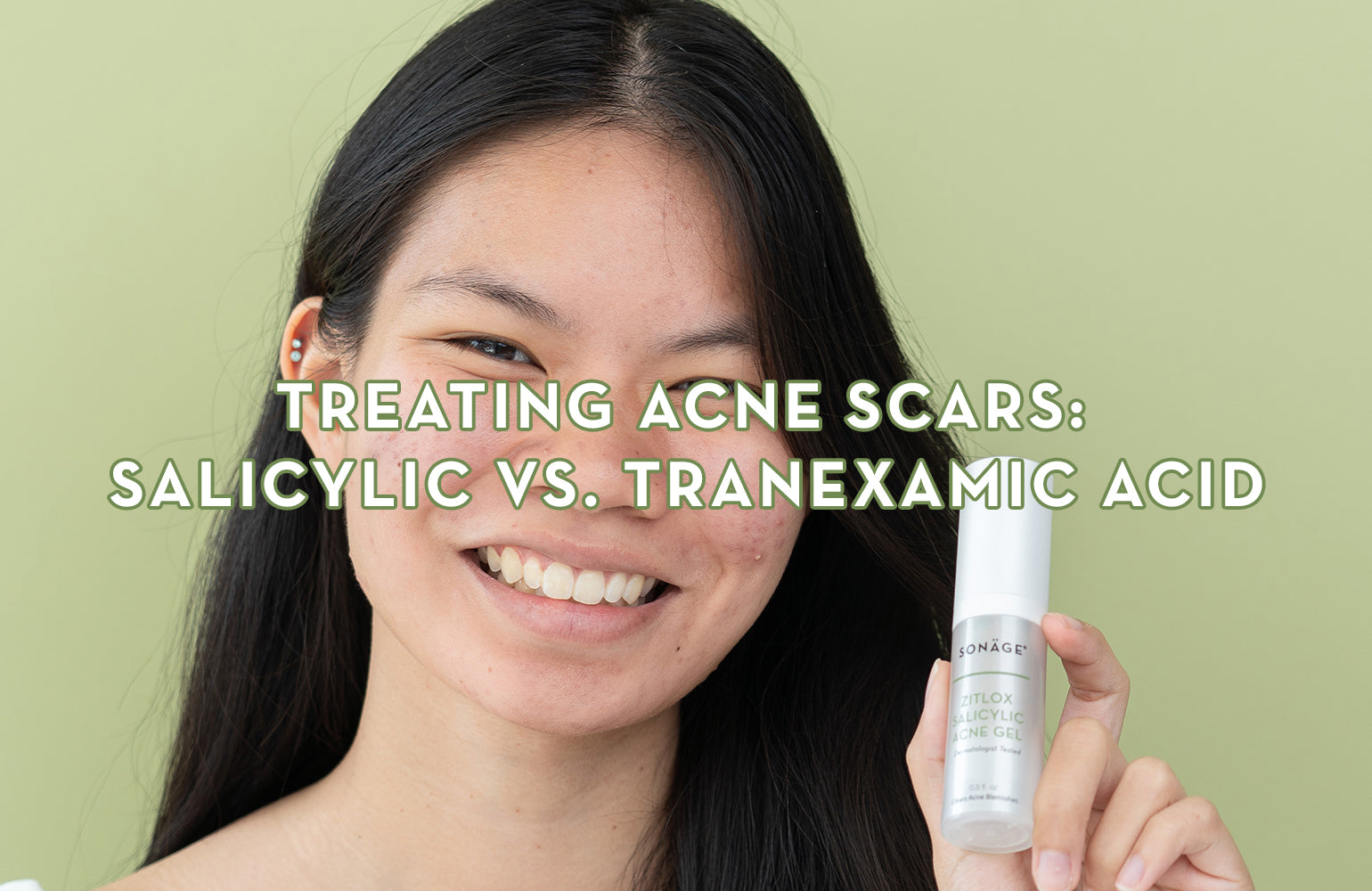 Treating Acne Scars: Salicylic vs. Tranexamic Acid