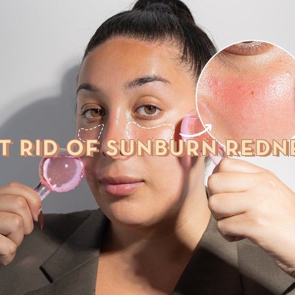 Skøn teenagere session Get Rid of Sunburn Redness – Sonage Skincare