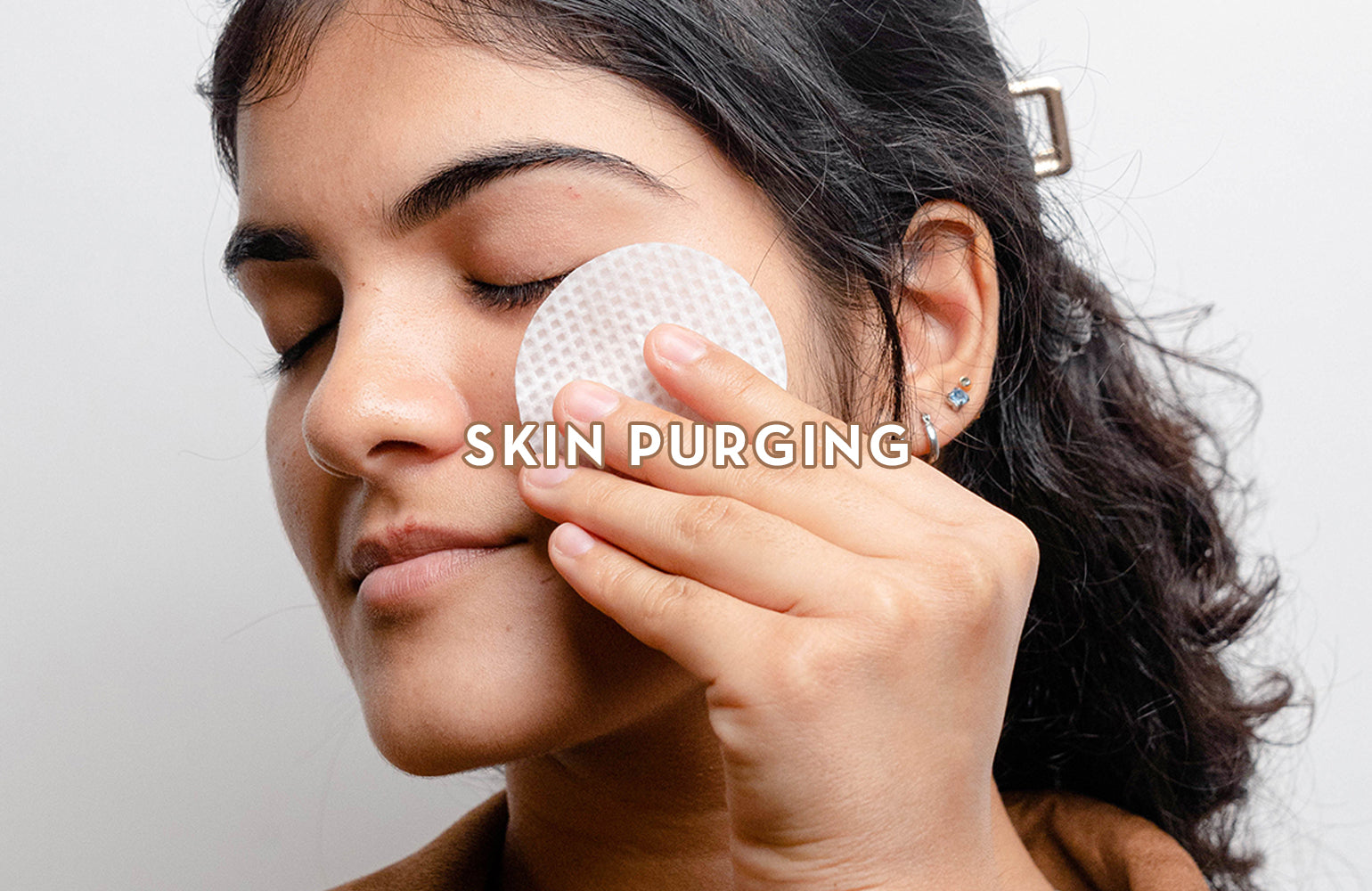 What is Skin Purging? How Does It Differ From Breakouts?